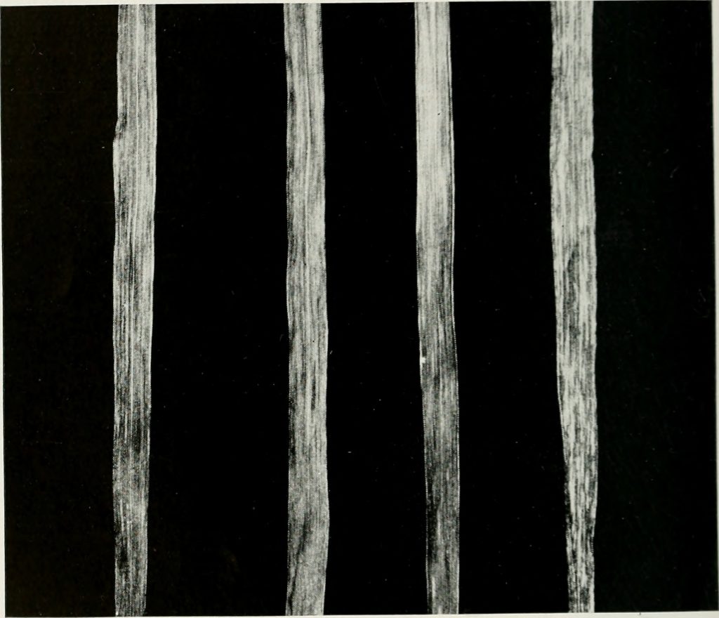 Wheat Yellow Mosaic Virus in Wheat Production: Regional Impacts on Crop Yield